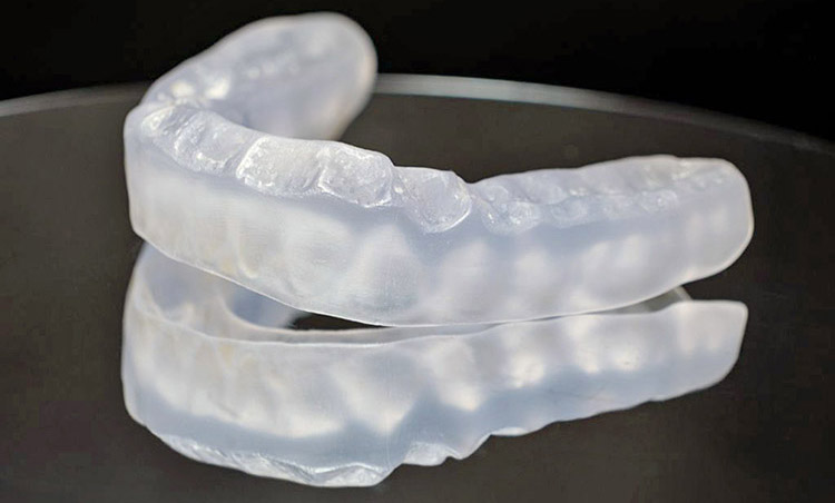 Trastorno Temporo Mandibular